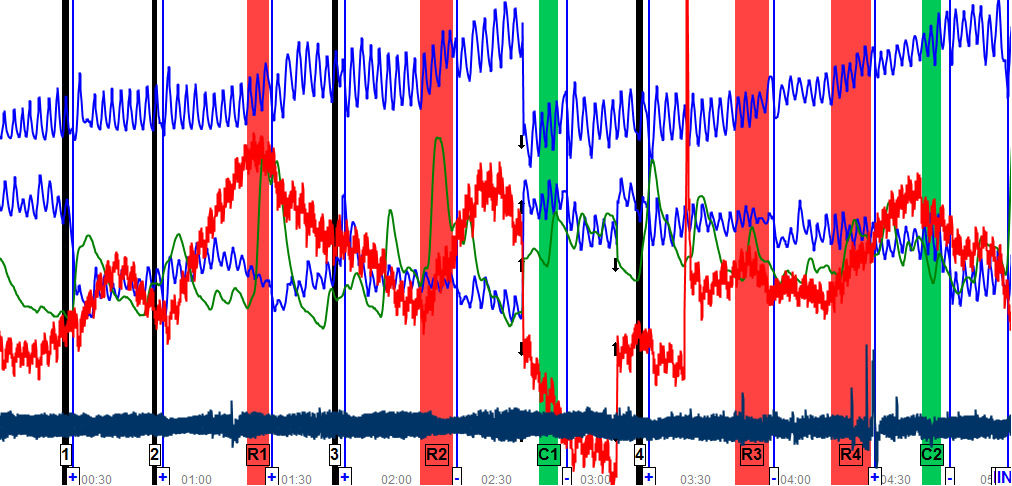 Alin Les@Toate drepturile rezervate